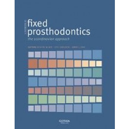 Fixed Prosthodontics, The Scandinavian approach
